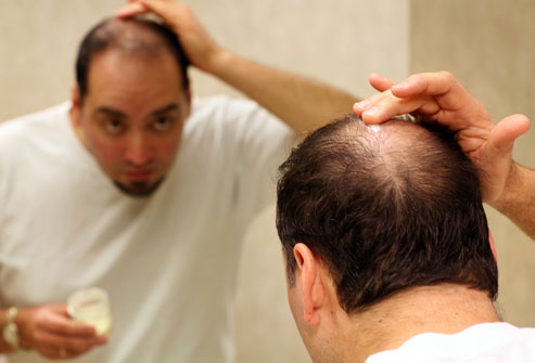 hair loss solutions for men