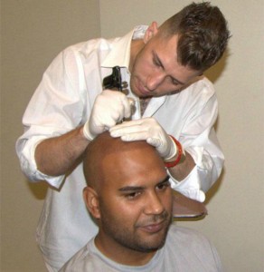 scalp
