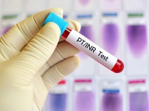 pt-inr-test