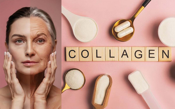 collagen